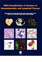 WHO Classification of Tumours of Haematopoietic and Lymphoid Tissues - Fourth Edition WHO Classification of Tumours of Haematopoietic and Lymphoid Tissues - Fourth Edition