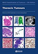 Thoracic tumours 5th edition, 2021 - Front
